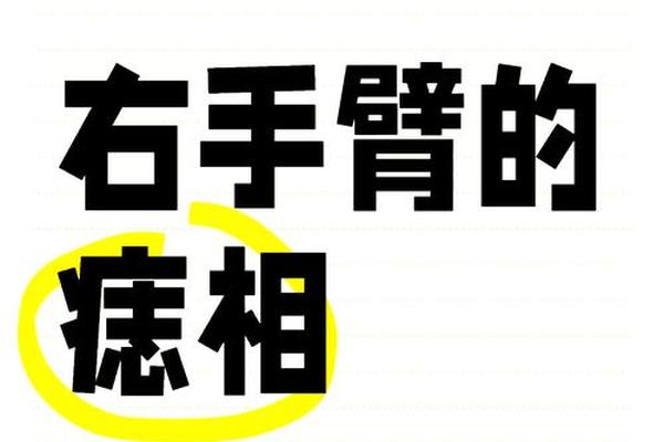 男女手臂上的痣相解说-胳膊有痣代表什么图解