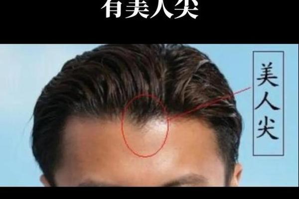 额头发际线痣相—美人尖发际线