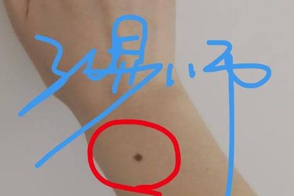 右手腕痣相最准图(女人右手手腕长痣图解)