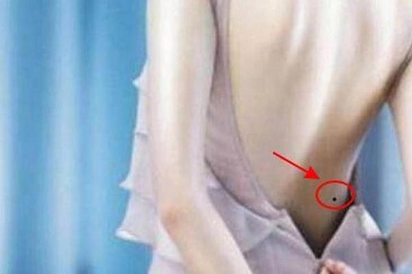 男人腰上有痣一相全解、男人左腰部有痣好不好