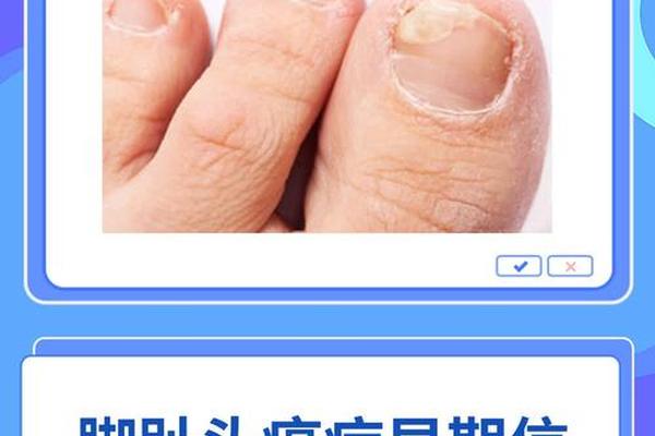脚趾尖痣相,手指尖脚趾尖偶尔刺痛
