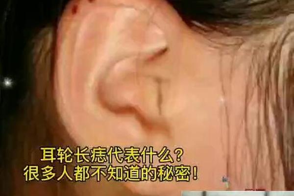 女人耳轮痣相—耳轮有痣的女人富贵吗