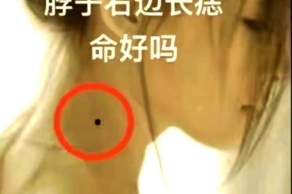 锁骨痣痣相 锁骨上的痣图解大全 女性