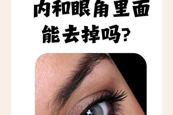 痣相眼睛里面有痣好吗(眼睛里面有颗痣好不好)
