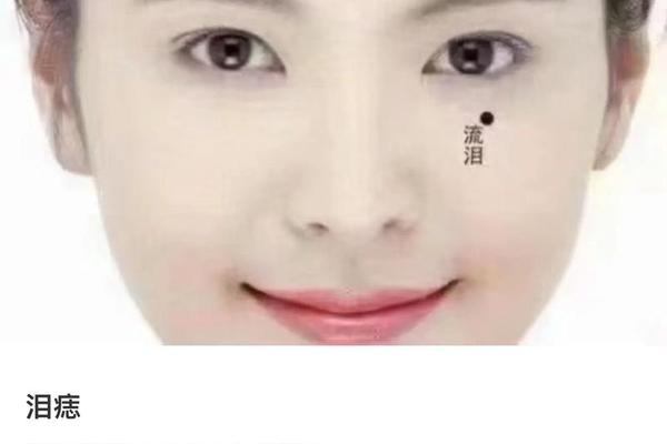 女生眼睛痣相,眼下痣相图解大全