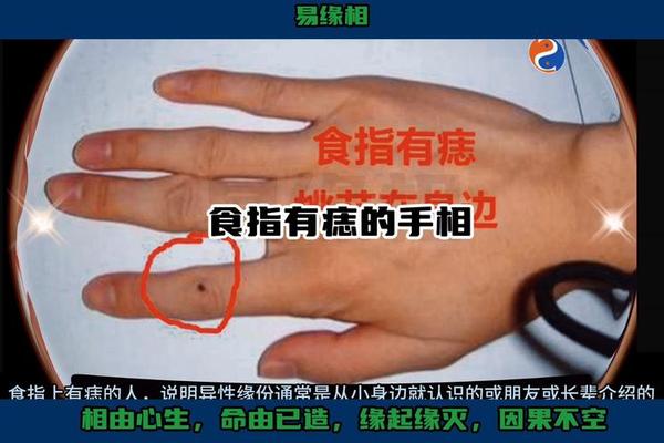 痣相手指 手指有痣意味着什么