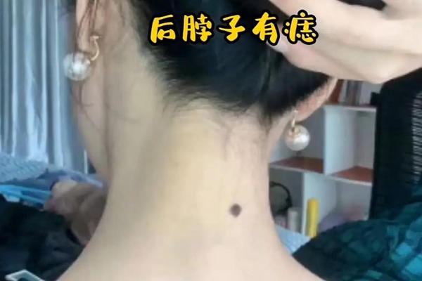 身上最有福气的10痣相-最有福气的10处胎记
