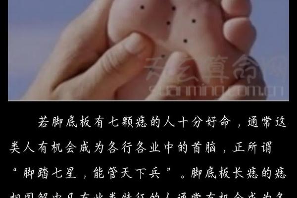 看脚长痣相算命图解_脚面长痣的位置图解