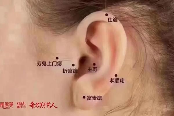 耳朵耳边痣相(耳朵痣相图解)