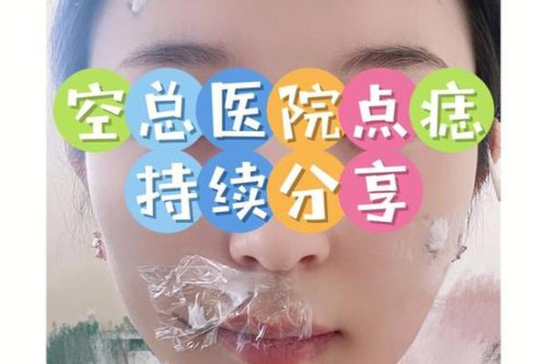 相城哪里可以点痣的医院,医院点痣挂什么科