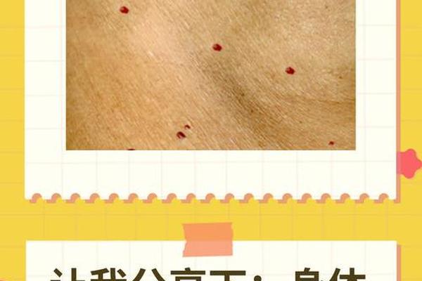 女人身上长红痣痣相—身上长红痣是什么预兆 女人身上长红痣痣相—身上长红痣是什么预兆