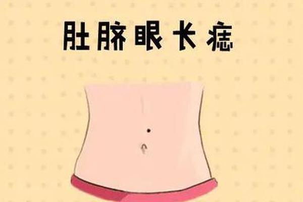 肚脐下有痣相代表什么 肚脐眼下面有颗痣是什么意思