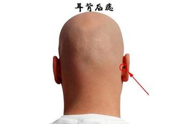 男人耳朵附近痣一相全解_男人痣相图解十大福痣
