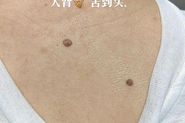 人的腰背痣相_男人面部痣相最准图