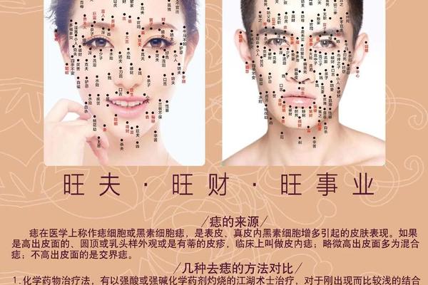 痣相相似的痣叫什么(痣还有什么叫法)