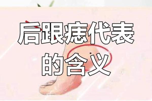 脚跟痣相的详细解读,脚跟长痣富贵图解