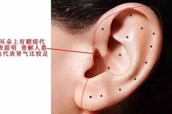 耳朵边长痣相;耳廓边长痣好吗