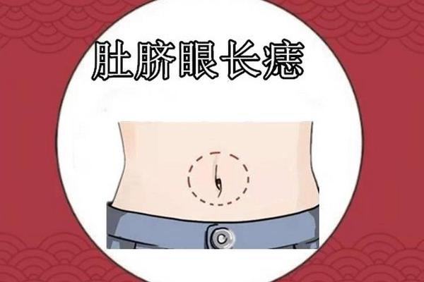 肚脐上有痣富相(肚脐有痣图片大全) 肚脐上有痣富相(肚脐有痣图片大全)