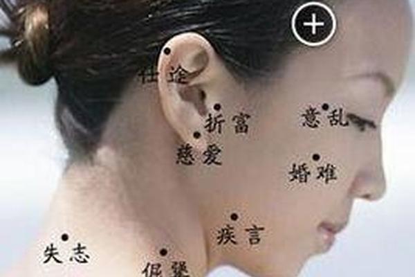 痣相解析脖子长痣-脖子上长痣相图解