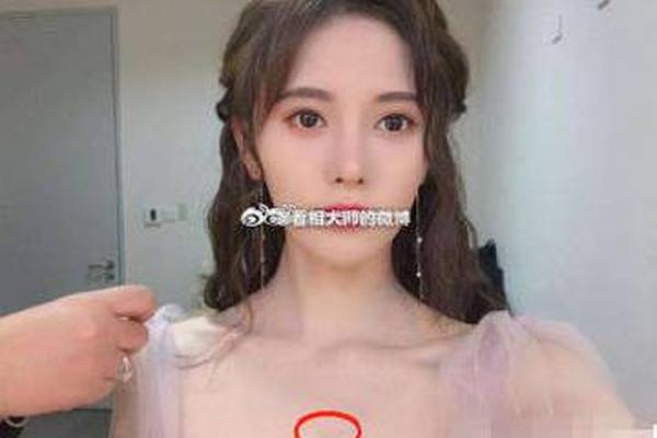 胸怀大痣的痣相;胸有大痣代表什么