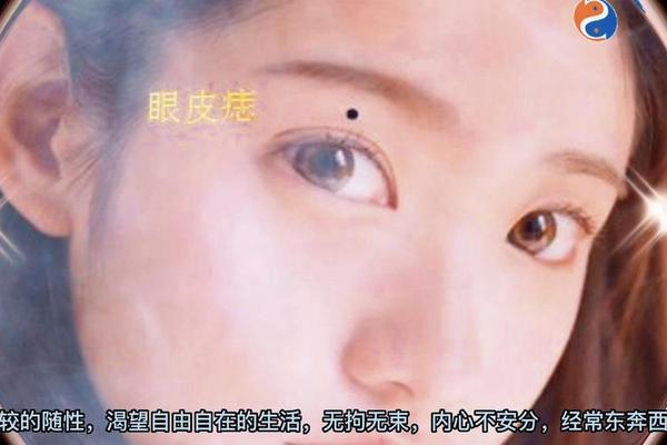 眼俭上有痣相,长在眼睑上的痣图片