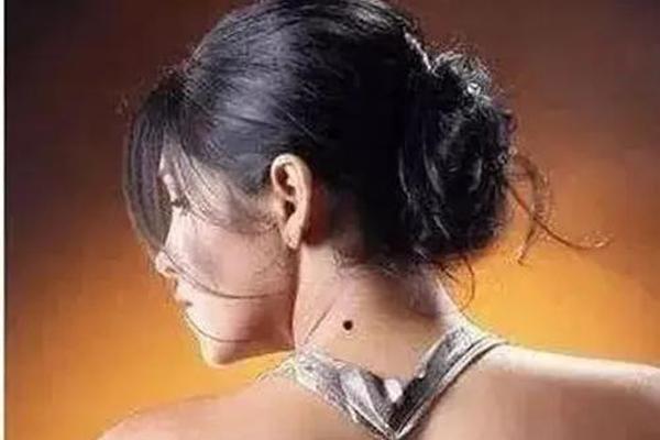 脖子肩膀痣相 肩膀靠近脖子地方有痣