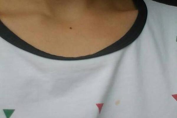 脖子下方痣相—颈部下方长痣代表什么