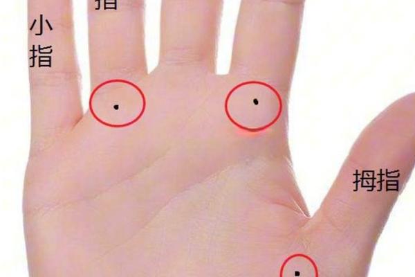 痣相女人手上部痣相图解;女人手部痣解析