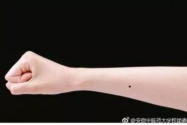 手掌心长了个黑痣痣相 手掌长个黑色痣代表什么