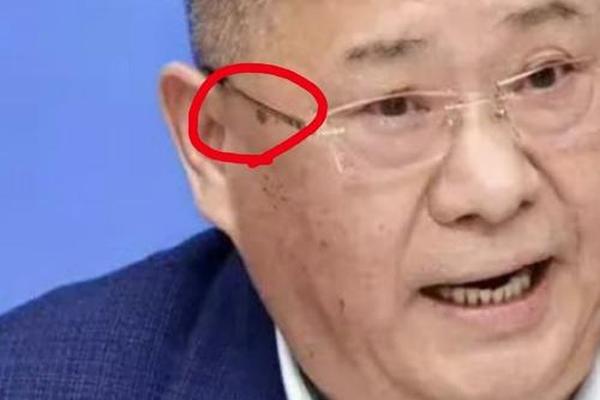 男人痣相眼尾—右眼尾有痣的男人