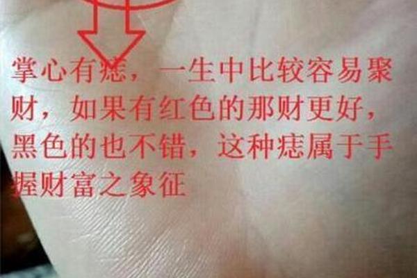 会有横财的痣相,有横财的痣长在哪里
