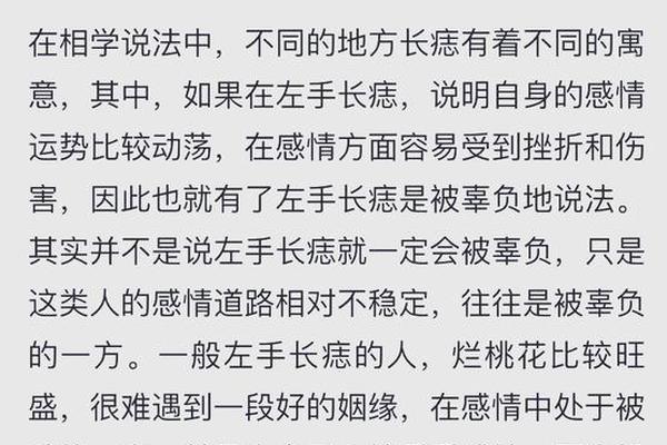 左手有痣相-左手痣相图解大全