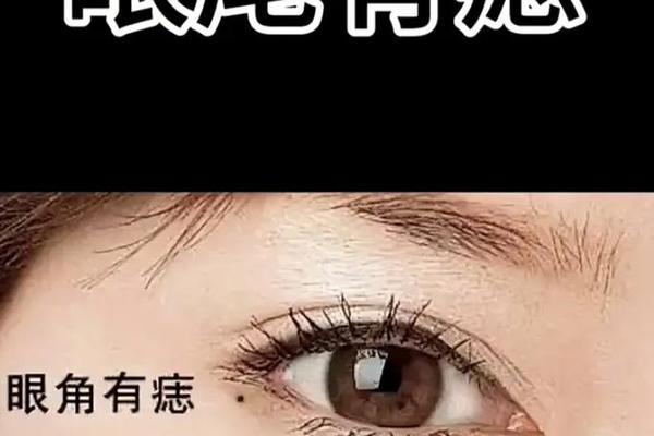 右眼皮上有痣的女人相 女人右眼皮有痣好不好 右眼皮上有痣的女人相 女人右眼皮有痣好不好
