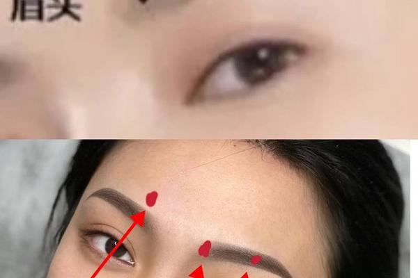 眉毛上长肉痣相—眉毛上长肉痣的图片