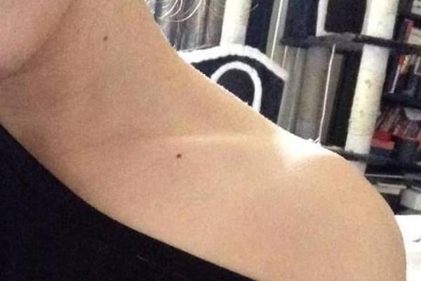女痣相下身 女人下身长痣代表什么