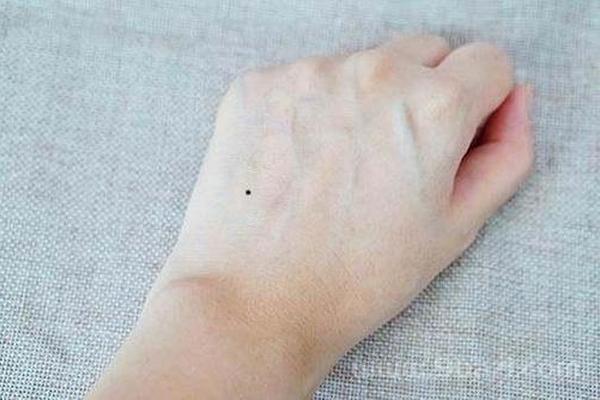 女人右手臂痣相_右手有痣图片大全