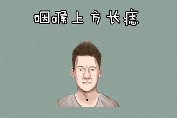 喉部痣相(痣在喉咙中间代表什么)