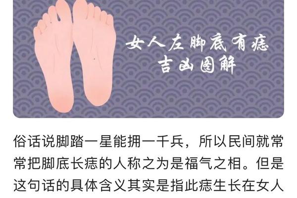 脚底板有痣相(脚底板长痣图解大全)