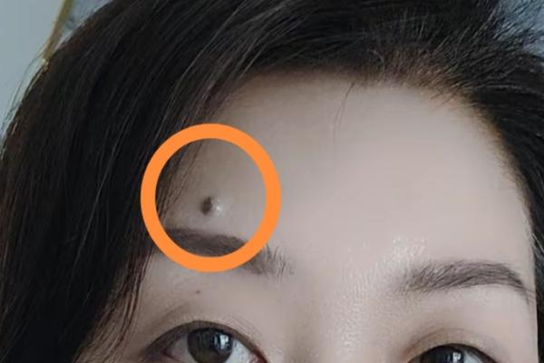 痣相缘红姐(媒婆痣位置)