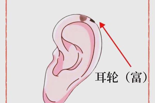 麻衣神相痣在耳旁,耳朵有痣的命运 图解