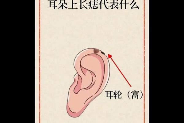 男生耳朵痣相;男人身上痣相大全图解