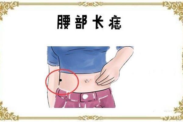 腰上有痣相—腰上有个痣好不好