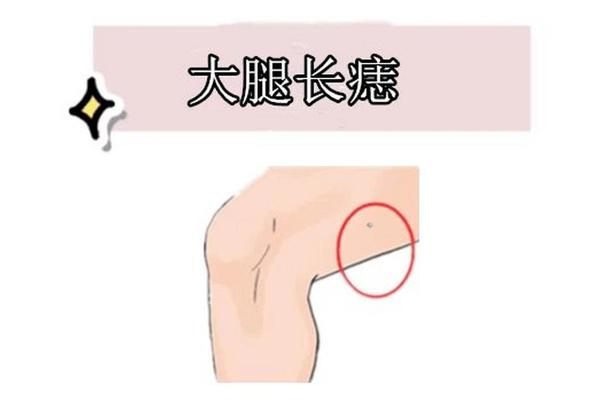 右大腿内侧痣相-大腿根部内侧长痣寓意
