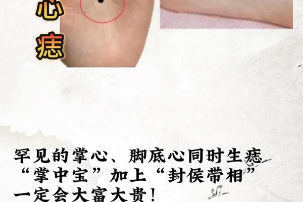 易经实用掌相掌心有痣—手掌内有痣图解 易经实用掌相掌心有痣—手掌内有痣图解