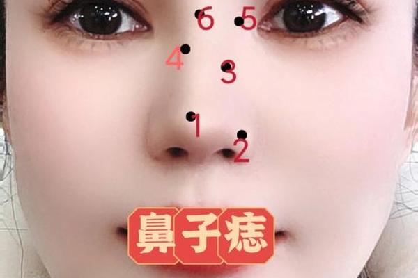 女命鼻子痣相_女鼻翼长痣好不好