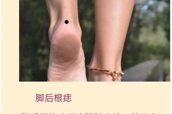 右脚后跟痣相解释(右脚脚后跟有个痣)