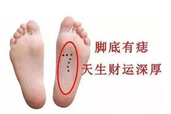 脚相算命小脚趾长痣_小脚趾长痣图解大全