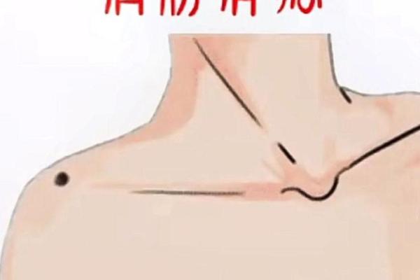 痣相男肩膀(全身痣相图解大全)