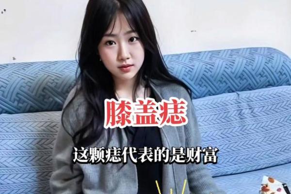 痣相右膝盖有痣_右膝盖有痣图解 痣相右膝盖有痣_右膝盖有痣图解