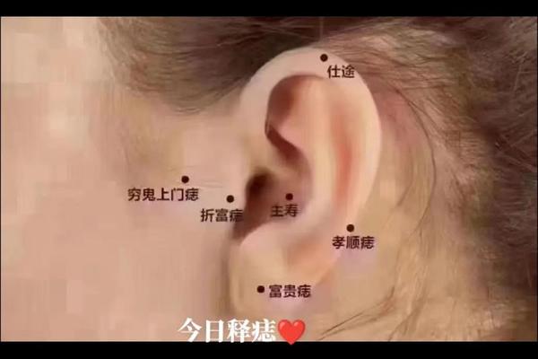 耳下痣相大全图解_耳朵边上的痣图解大全